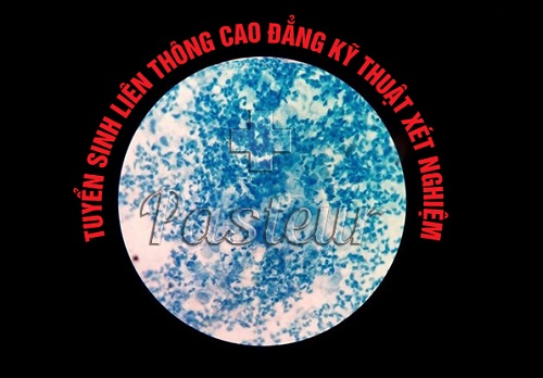Thời gian đào tạo Liên thông Cao đẳng Xét nghiệm năm 2018 bao lâu? Thời gian đào tạo Liên thông Cao đẳng Xét nghiệm năm 2018 bao lâu?